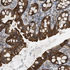 Immunohistochemical staining of human rectum shows strong cytoplasmic positivity in glandular cells.