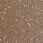 Immunohistochemical staining of human cerebral cortex shows strong cytoplasmic positivity in neuropil.