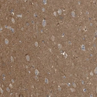 Immunohistochemical staining of human cerebral cortex shows strong cytoplasmic positivity in neuropil.