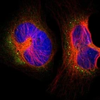 Immunofluorescent staining of human cell line U-2 OS shows localization to cytosol & vesicles.
