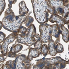Anti-NRK Antibody