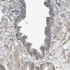 Immunohistochemical staining of human prostate shows moderate granular cytoplasmic positivity in glandular cells.