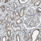 Immunohistochemical staining of human kidney shows moderate granular cytoplasmic positivity in cells in tubules.