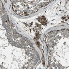 Immunohistochemical staining of human testis shows moderate cytoplasmic positivity in Leydig cells.