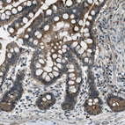 Immunohistochemical staining of human colon shows moderate cytoplasmic positivity in glandular cells.