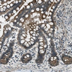 Immunohistochemical staining of human colon shows moderate cytoplasmic positivity in glandular cells.