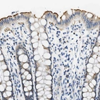 Immunohistochemical staining of human rectum shows strong positivity in apical membrane in glandular cells.