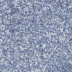Immunohistochemical staining of human lymph node shows no positivity in non-germinal center cells as expected.