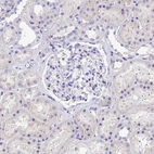 Immunohistochemical staining of human kidney shows weak cytoplasmic positivity in cells in tubules.