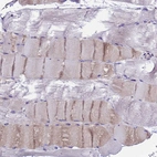 Immunohistochemical staining of human skeletal muscle shows weak cytoplasmic positivity in myocytes.