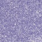 Immunohistochemical staining of human lymph node shows no positivity in non-germinal center cells as expected.