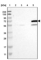Lane 1: Marker [kDa] 230, 130, 95, 72, 56, 36, 28, 17, 11_br/_Lane 2: Human cell line RT-4_br/_Lane 3: Human cell line U-251MG sp_br/_Lane 4: Human plasma (IgG/HSA depleted)_br/_Lane 5: Human liver tissue