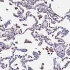 Anti-PLXDC2 Antibody