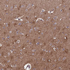 Immunohistochemical staining of human cerebral cortex shows moderate to strong cytoplasmic positivity in microglia and neuropil.