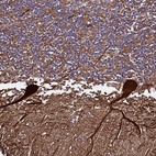 Immunohistochemical staining of human cerebellum shows strong cytoplasmic positivity in Purkinje cells.