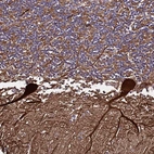 Immunohistochemical staining of human cerebellum shows strong cytoplasmic positivity in Purkinje cells.