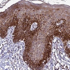 Immunohistochemical staining of human skin shows strong cytoplasmic/ membranous positivity in squamous epithelial cells.
