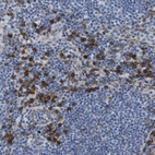 Anti-ST3GAL2 Antibody