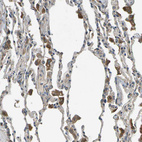 Immunohistochemical staining of human lung shows moderate cytoplasmic positivity in macrophages.