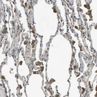 Immunohistochemical staining of human lung shows moderate cytoplasmic positivity in macrophages.