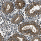 Immunohistochemical staining of human endometrium shows moderate cytoplasmic positivity in glandular cells.