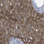 Immunohistochemical staining of human liver shows strong cytoplasmic positivity in hepatocytes.