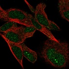 Immunofluorescent staining of human cell line SH-SY5Y shows localization to nucleus & vesicles.