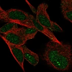 Immunofluorescent staining of human cell line SH-SY5Y shows localization to nucleus & vesicles.