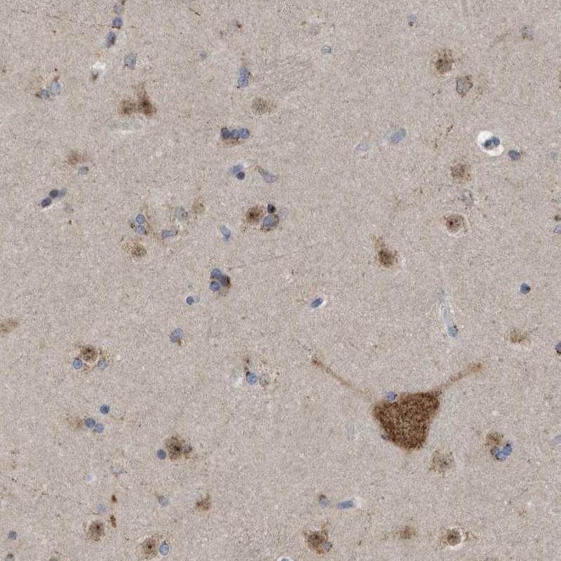 Anti-FAM69A Antibody