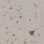 Anti-FAM69A Antibody