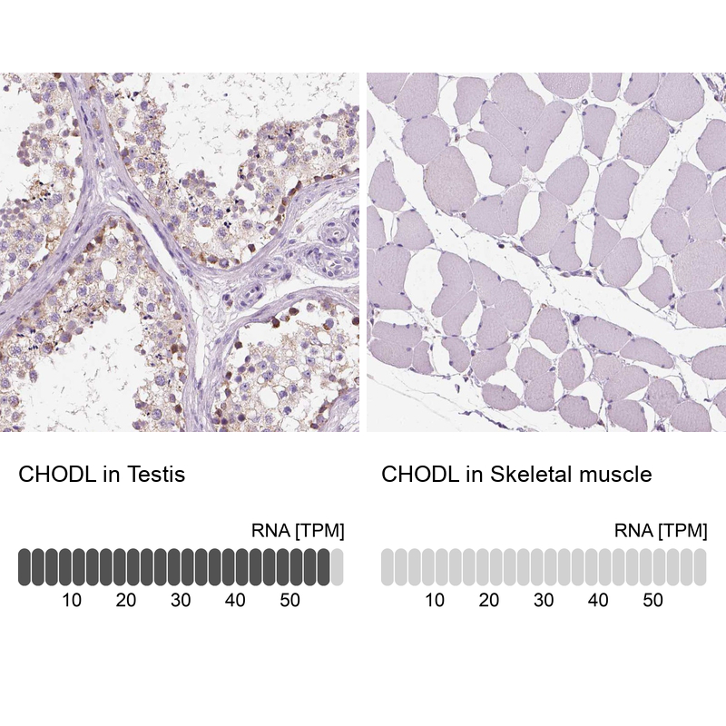 Anti-CHODL Antibody