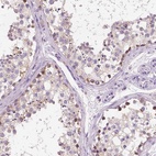 Immunohistochemical staining of human testis shows high expression.