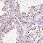 Immunohistochemical staining of human testis shows high expression.