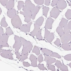 Immunohistochemical staining of human skeletal muscle shows low expression as expected.