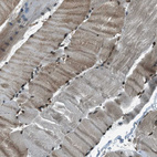 Anti-TARDBP Antibody