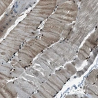 Anti-TARDBP Antibody