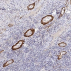 Anti-FRMD3 Antibody