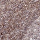 Immunohistochemical staining of human Tonsil shows moderate membranous positivity in non-germinal center cells.