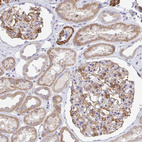 Immunohistochemical staining of human Kidney shows moderate membranous positivity in cells in glomeruli.