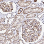 Immunohistochemical staining of human Kidney shows moderate membranous positivity in cells in glomeruli.