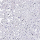 Immunohistochemical staining of human Liver shows no positivity in hepatocytes as expected.