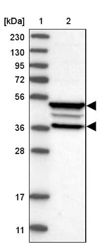 Lane 1: Marker [kDa] 230, 130, 95, 72, 56, 36, 28, 17, 11_br/_Lane 2: Human cell line RT-4