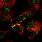 Immunofluorescent staining of human cell line SH-SY5Y shows localization to nucleoplasm & plasma membrane.