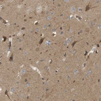 Immunohistochemical staining of human cerebral cortex shows strong cytoplasmic positivity in neuronal cells.
