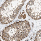 Immunohistochemical staining of human testis shows moderate cytoplasmic positivity in cells in seminiferous ducts and leydig cells.