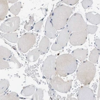 Immunohistochemical staining of human skeletal muscle shows weak cytoplasmic positivity in myocytes as expected.