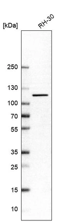 Western blot analysis in human cell line RH-30.