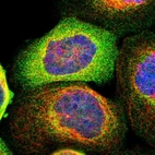 Immunofluorescent staining of human cell line A-431 shows localization to cytosol.
