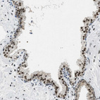 Immunohistochemical staining of human prostate shows strong nuclear positivity in glandular cells.
