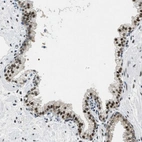 Immunohistochemical staining of human prostate shows strong nuclear positivity in glandular cells.
